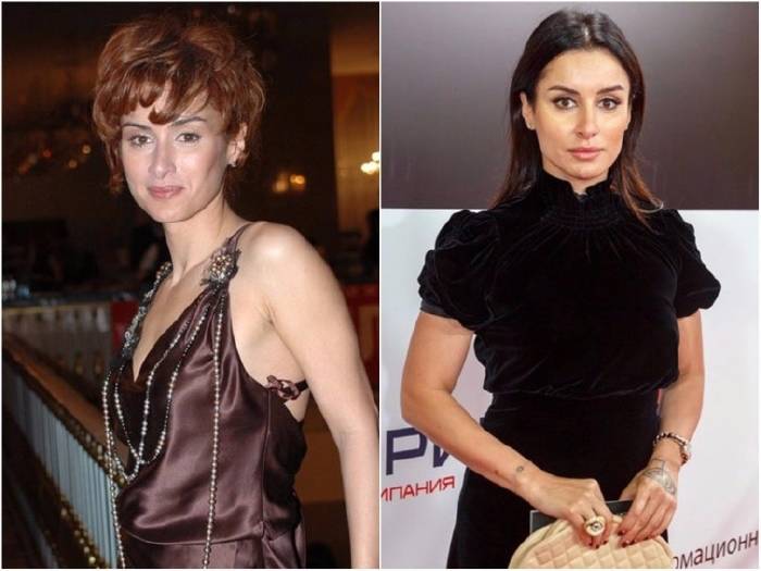 famosas antes y despues